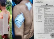 “Tidak Ada Alasan Membenarkan Kekerasan!”  Wilson Lalengke Kecam Penganiayaan Berat di Bogor, Desak Polisi Tangkap Imron
