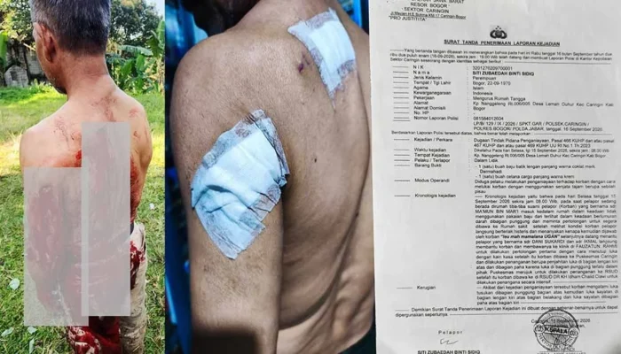 “Tidak Ada Alasan Membenarkan Kekerasan!”  Wilson Lalengke Kecam Penganiayaan Berat di Bogor, Desak Polisi Tangkap Imron
